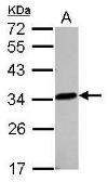 Anti-LACTB2 antibody used in Western Blot (WB). GTX122755