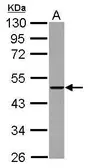 Anti-THUMPD2 antibody used in Western Blot (WB). GTX122789
