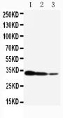 Anti-TORC2 antibody used in Western Blot (WB). GTX12282