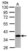 Anti-STUB1 antibody [N1C3] used in Western Blot (WB). GTX122827