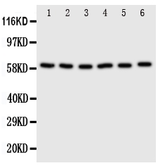 Anti-SCLY antibody used in Western Blot (WB). GTX12283