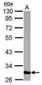 Anti-GOLPH3 antibody [N1C3] used in Western Blot (WB). GTX122856