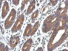 Anti-CCDC127 antibody used in IHC (Paraffin sections) (IHC-P). GTX122888