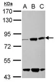 Anti-KLHL22 antibody used in Western Blot (WB). GTX122894