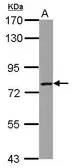 Anti-LCMT2 antibody used in Western Blot (WB). GTX122895