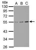 Anti-GCNT3 antibody used in Western Blot (WB). GTX122901