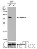 Anti-LRRC59 antibody used in Western Blot (WB). GTX122902