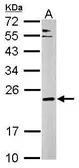 Anti-Complexin 3 antibody used in Western Blot (WB). GTX122908