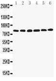 Anti-LPP antibody used in Western Blot (WB). GTX12294