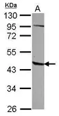 Anti-AGPAT5 antibody [N1C2] used in Western Blot (WB). GTX122943