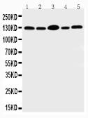 Anti-CD133 antibody used in Western Blot (WB). GTX12295