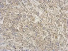 Anti-RNASE11 antibody used in IHC (Paraffin sections) (IHC-P). GTX122951
