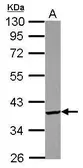Anti-PDIK1L antibody [N2C3] used in Western Blot (WB). GTX122965