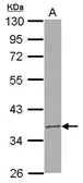 Anti-RPUSD3 antibody [N3C3] used in Western Blot (WB). GTX122992