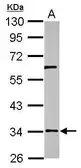 Anti-RPUSD3 antibody [N1C2] used in Western Blot (WB). GTX122993