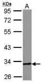 Anti-HIBADH antibody used in Western Blot (WB). GTX122994