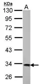 Anti-HIBADH antibody used in Western Blot (WB). GTX122995