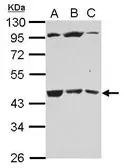 Anti-B3GALT4 antibody used in Western Blot (WB). GTX122999
