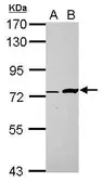 Anti-C5orf54 antibody used in Western Blot (WB). GTX123000