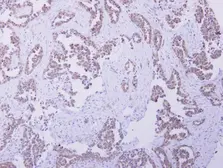Anti-CBR4 antibody [N1C3] used in IHC (Paraffin sections) (IHC-P). GTX123009