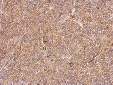 Anti-CCDC105 antibody [N2C2], Internal used in IHC (Paraffin sections) (IHC-P). GTX123024