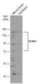 Anti-KCNH7 antibody [N1N2], N-term used in Western Blot (WB). GTX123026