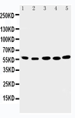 Anti-ABI2 antibody used in Western Blot (WB). GTX12303