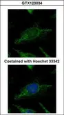 Anti-SUPV3L1 antibody [C2C3], C-term used in Immunocytochemistry/ Immunofluorescence (ICC/IF). GTX123034