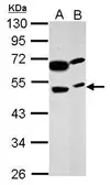 Anti-PRSS35 antibody used in Western Blot (WB). GTX123037
