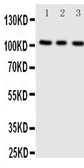 Anti-ADAMTS1 antibody used in Western Blot (WB). GTX12304