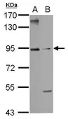 Anti-ARMC3 antibody used in Western Blot (WB). GTX123050
