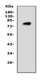 Anti-PCSK4 antibody used in Western Blot (WB). GTX12306