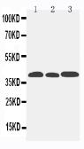 Anti-CCR5 antibody used in Western Blot (WB). GTX12309