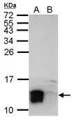 Anti-LYPD6 antibody used in Western Blot (WB). GTX123091