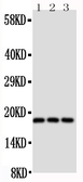 Anti-CD90 antibody used in Western Blot (WB). GTX12310