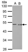 Anti-Pellino1 antibody [N1C1] used in Western Blot (WB). GTX123102