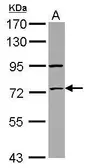 Anti-ZNF530 antibody used in Western Blot (WB). GTX123125