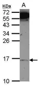 Anti-MRPL14 antibody used in Western Blot (WB). GTX123143