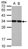 Anti-ENOPH1 antibody used in Western Blot (WB). GTX123148