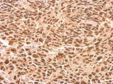 Anti-RED antibody used in IHC (Paraffin sections) (IHC-P). GTX123170