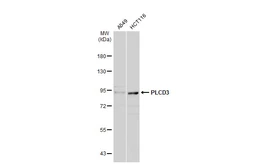 Anti-PLCD3 antibody used in Western Blot (WB). GTX123172