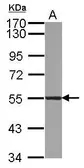 Anti-ATL3 antibody used in Western Blot (WB). GTX123176