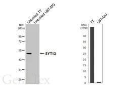 Anti-SYT13 antibody used in Western Blot (WB). GTX123188