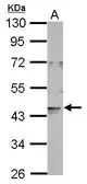 Anti-LONP2 antibody used in Western Blot (WB). GTX123193
