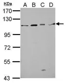 Anti-GRASP1 antibody used in Western Blot (WB). GTX123206
