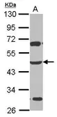 Anti-ZSCAN4 antibody used in Western Blot (WB). GTX123211