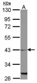 Anti-MRPL39 antibody used in Western Blot (WB). GTX123238