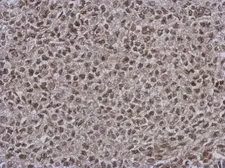 Anti-DNAJB7 antibody used in IHC (Paraffin sections) (IHC-P). GTX123260