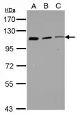Anti-Coronin 7 antibody used in Western Blot (WB). GTX123282