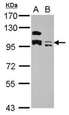 Anti-KCTD19 antibody used in Western Blot (WB). GTX123284